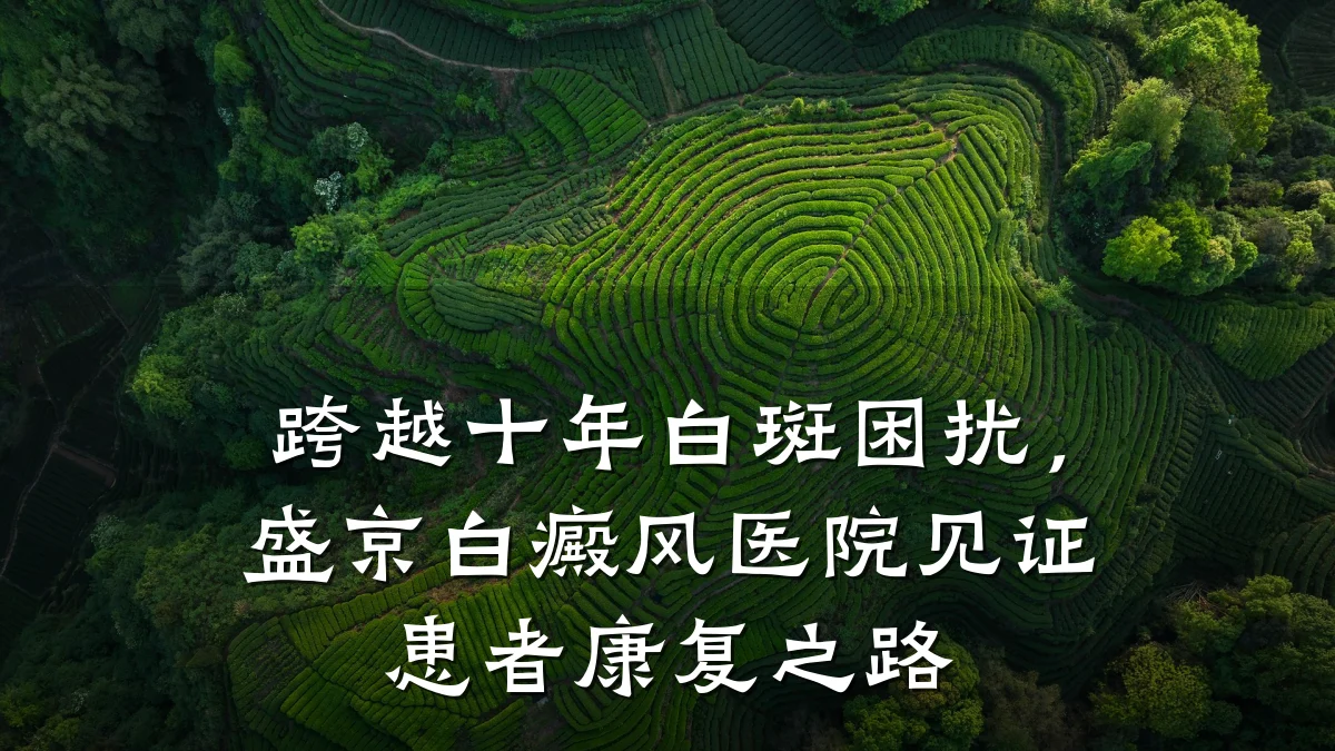 跨越十年白斑困扰，盛京白癜风医院见证患者康复之路